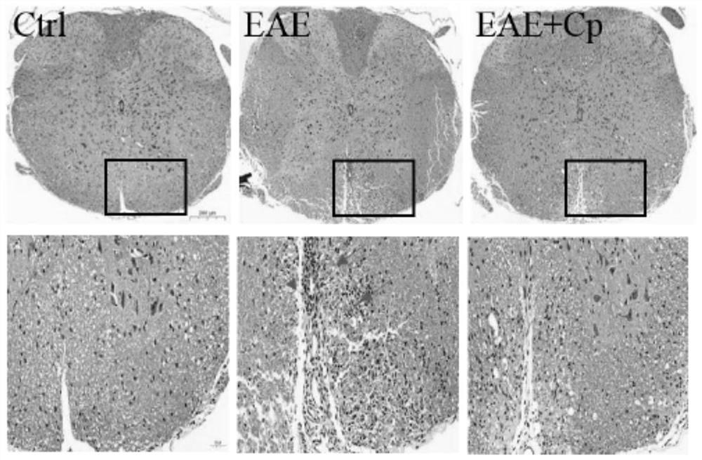 Novel application of ceruloplasmin in treatment of multiple sclerosis