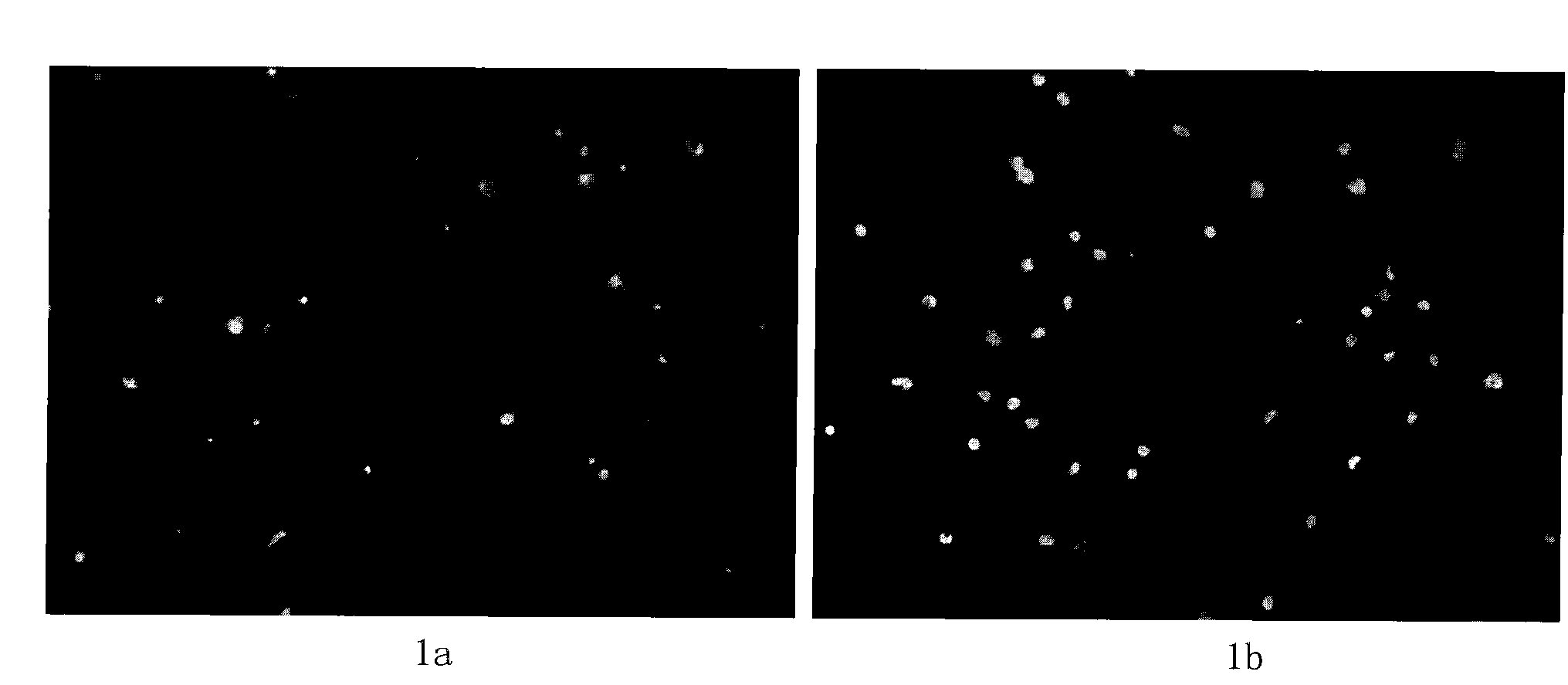 Neural stem cell culture amplification method and used culture medium