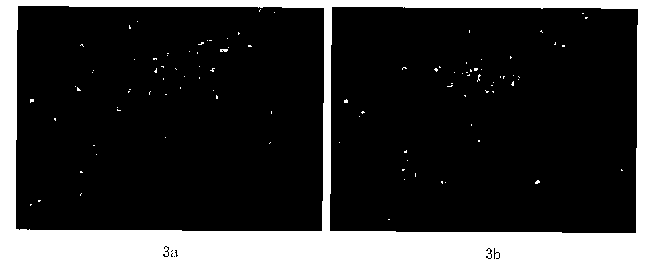 Neural stem cell culture amplification method and used culture medium