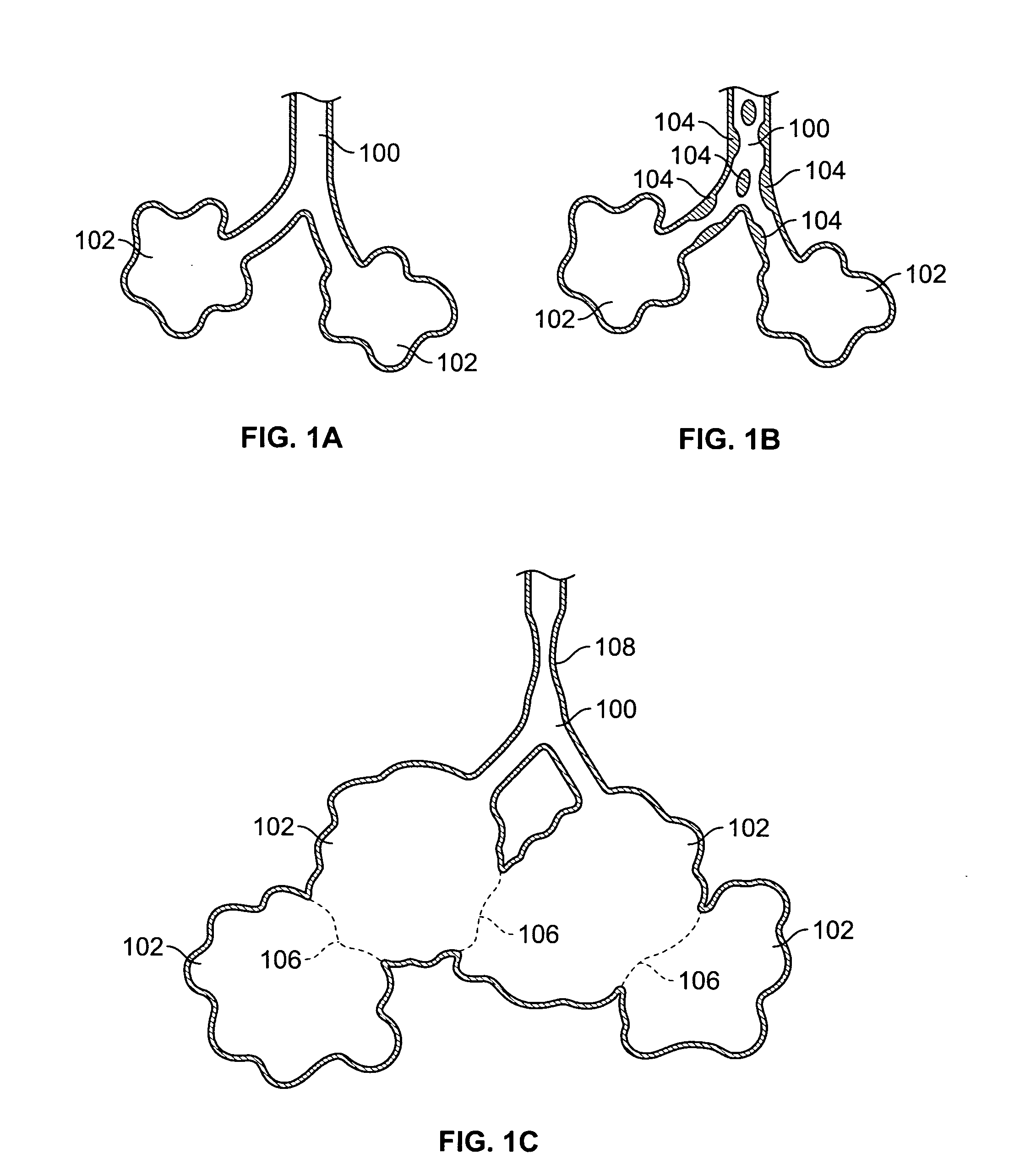 Methods and devices for maintaining patency of surgically created channels in a body organ