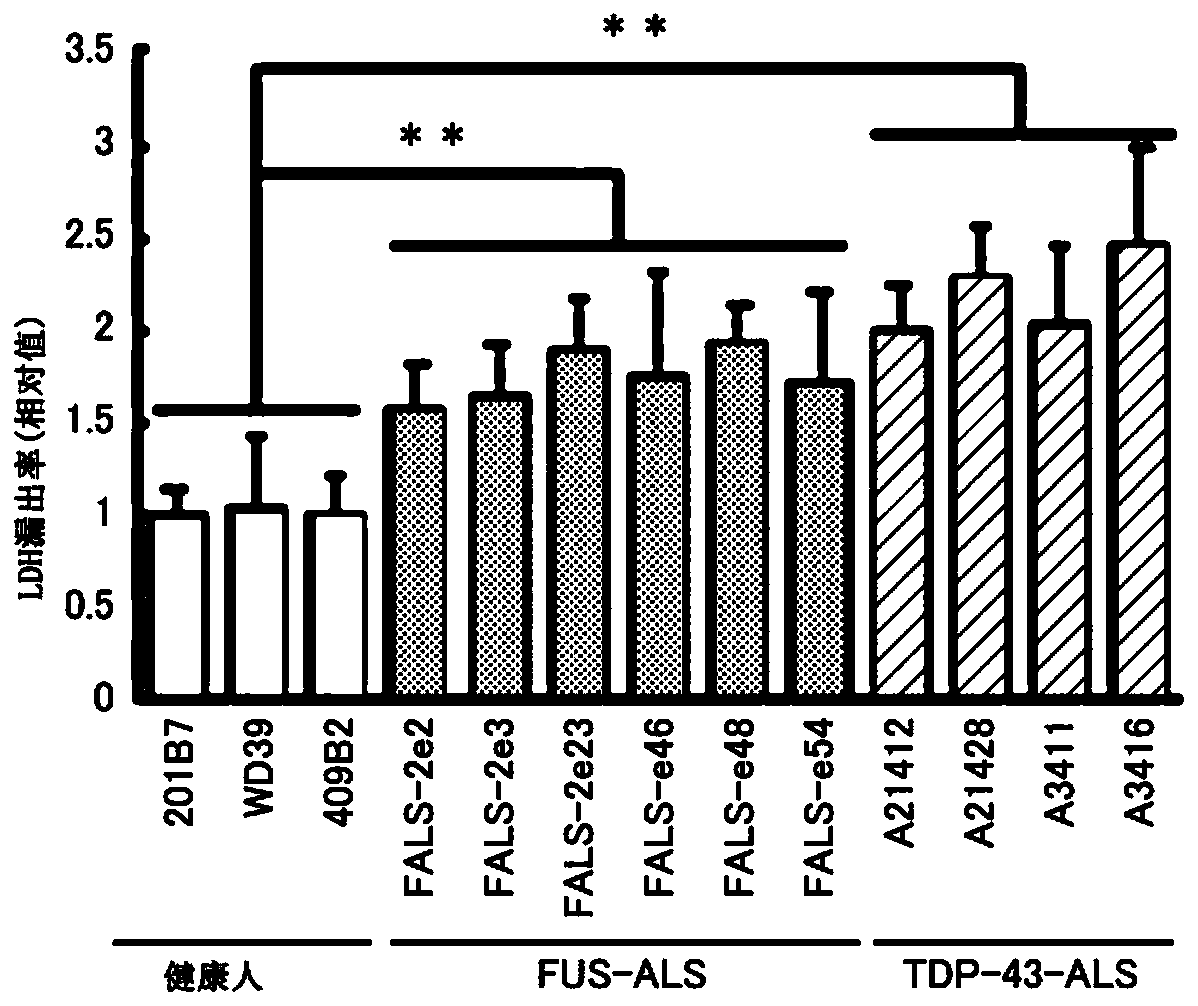 Therapeutic agent for amyotrophic lateral sclerosis and composition for treatment