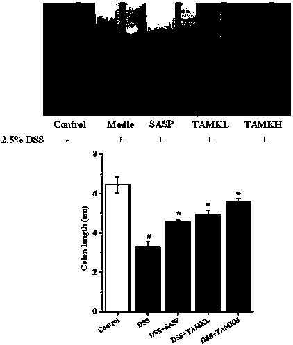 Application of total alkaloids in melodinus khasianus to preparation of medicine for preventing and treating inflammatory bowel disease