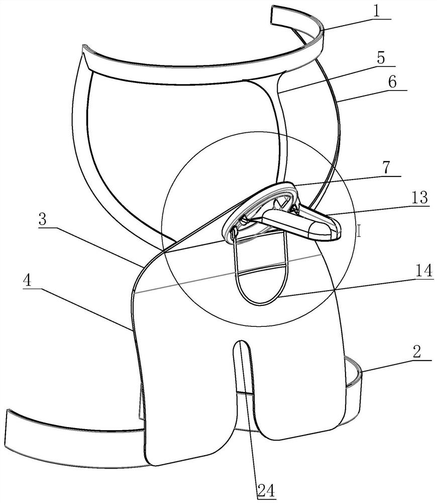 An isolation device for cryotherapy of scabies nodules