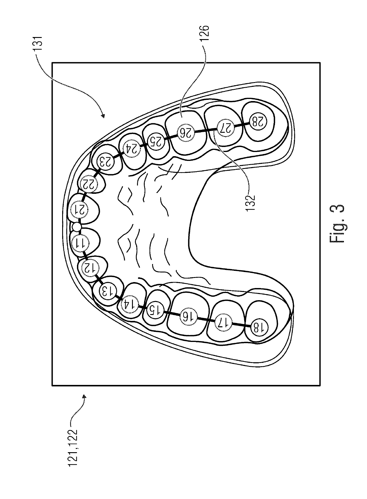 Method and device for determining dental plaque