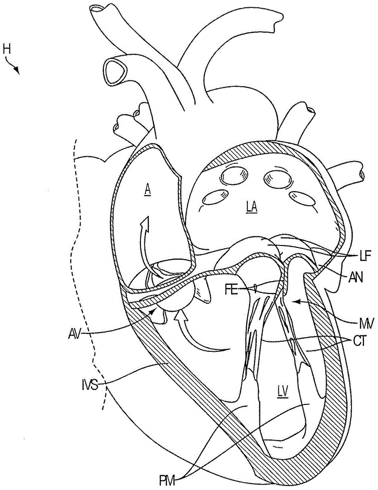 independent gripper