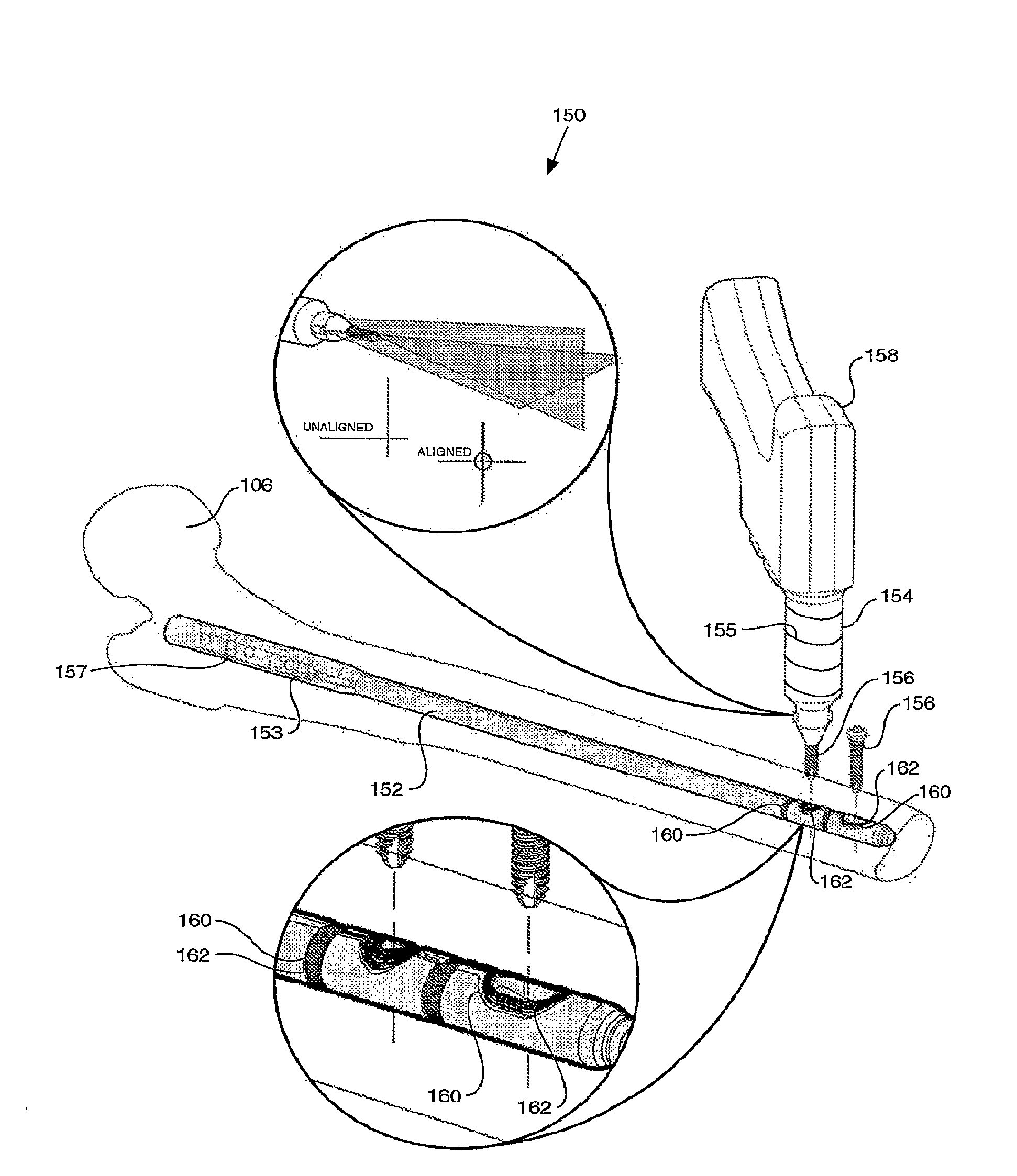 Instrumented orthopaedic implant for identifying a landmark