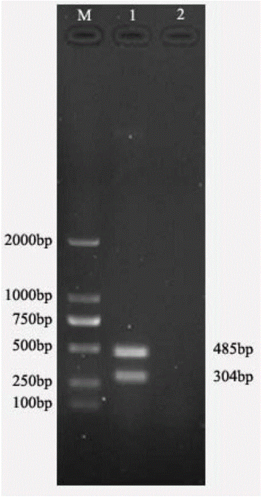 Primer and kit for detecting aminoglycoside drug resistance genes of aeromonas hydrophila