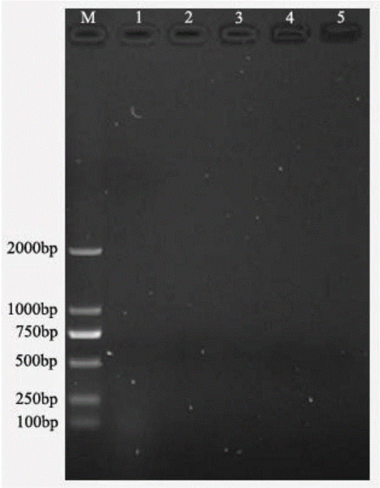 Primer and kit for detecting aminoglycoside drug resistance genes of aeromonas hydrophila