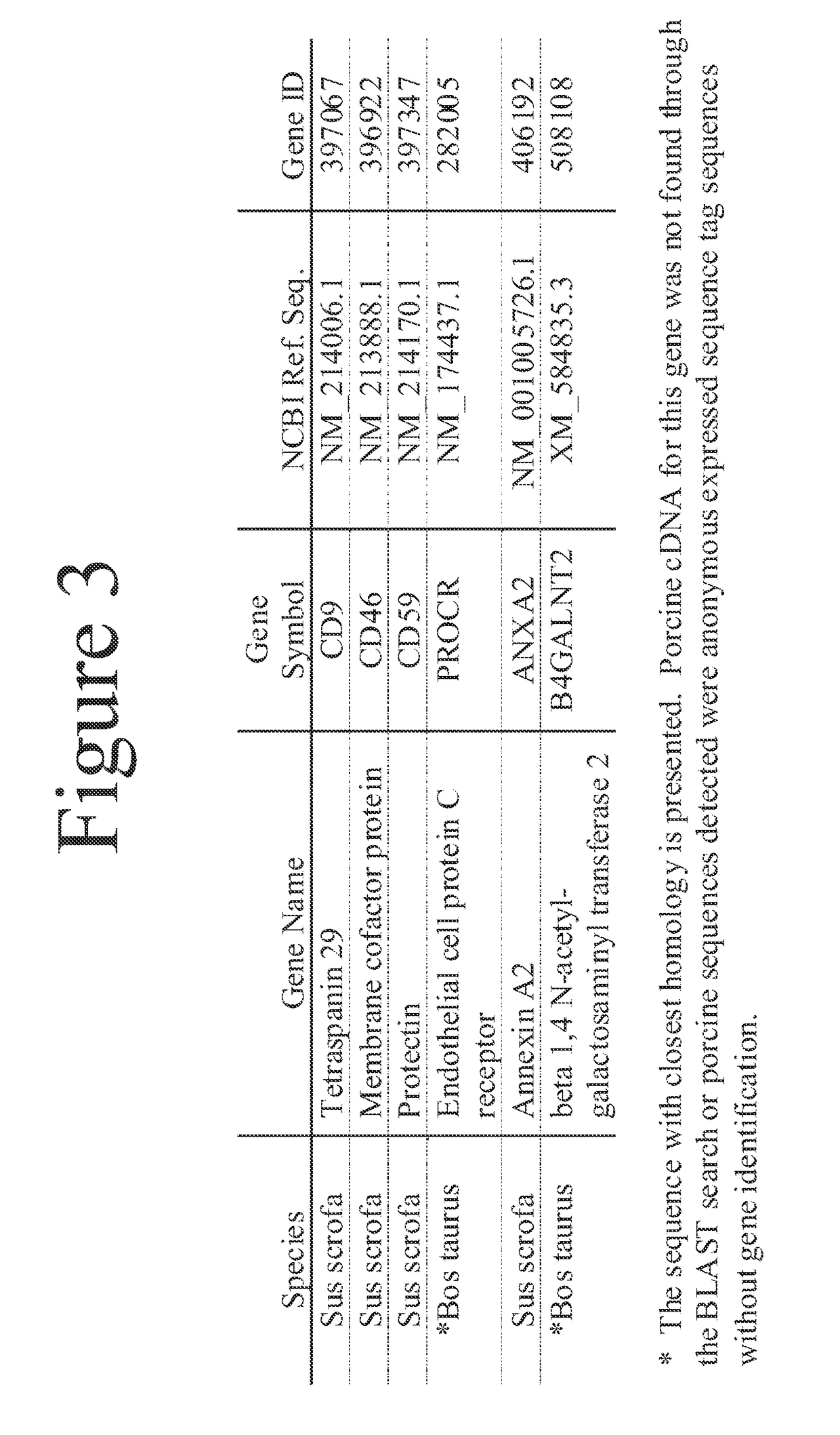 Implantation of a cardiac xenograft from a B4GALNT2KO and GTKO transgenic pig to reduce immunogenicity