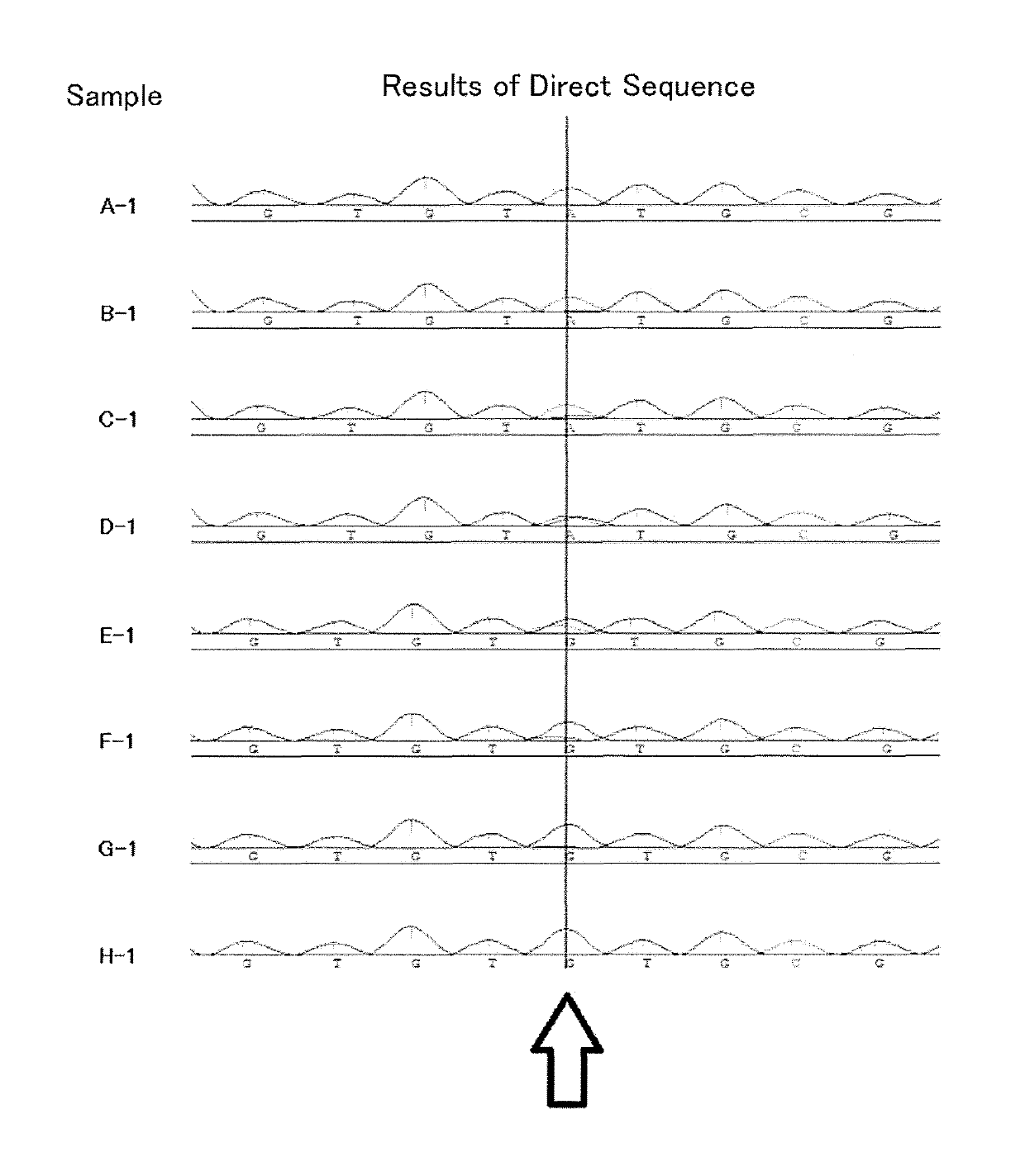 Detection method for mutation in 93rd amino acid of hepatitis C virus NS5A protein, and detection kit for mutation in 93rd amino acid of hepatitis C virus NS54 protein