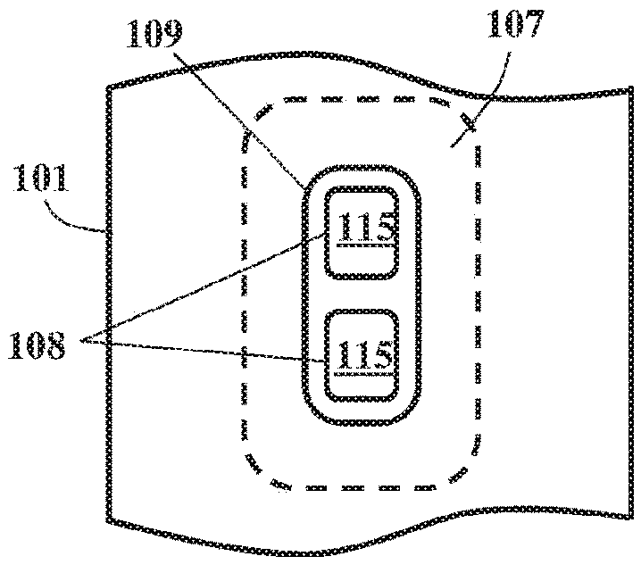 Balloon catheter with fortified proximal outlet port, and manufacturing thereof