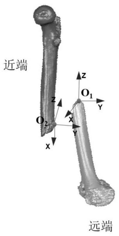 Robot-assisted fracture space collision-avoidance reduction path planning method