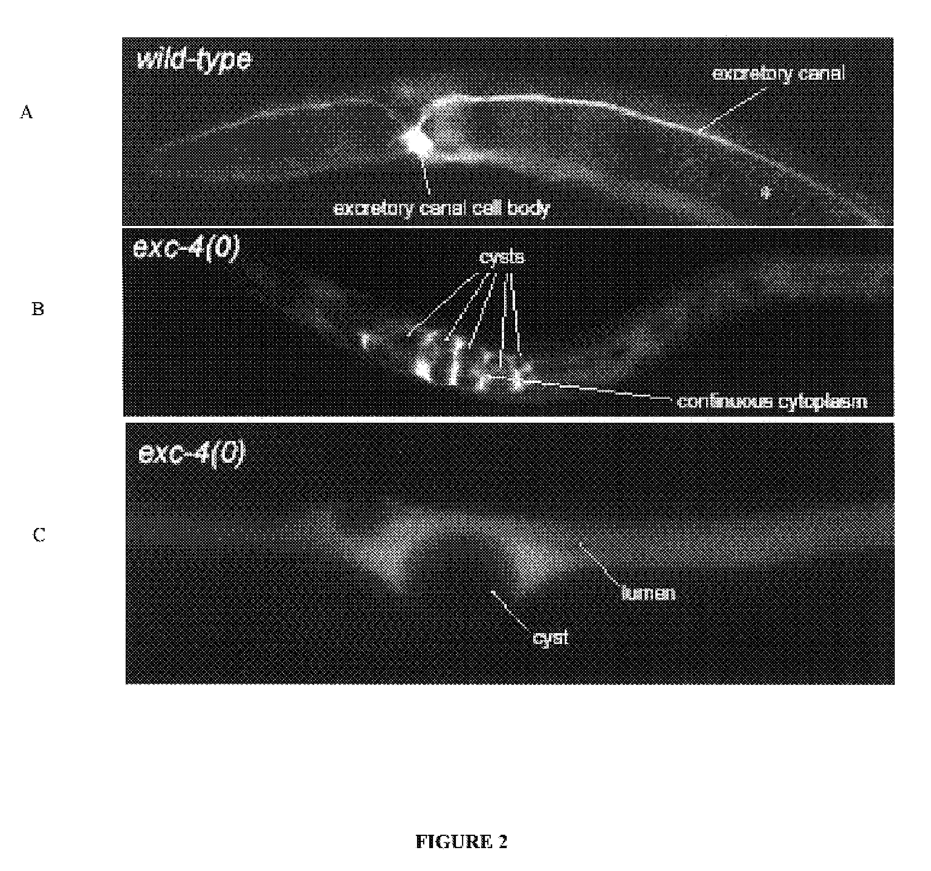 Method of screening for agents inhibiting chloride intracellular channels