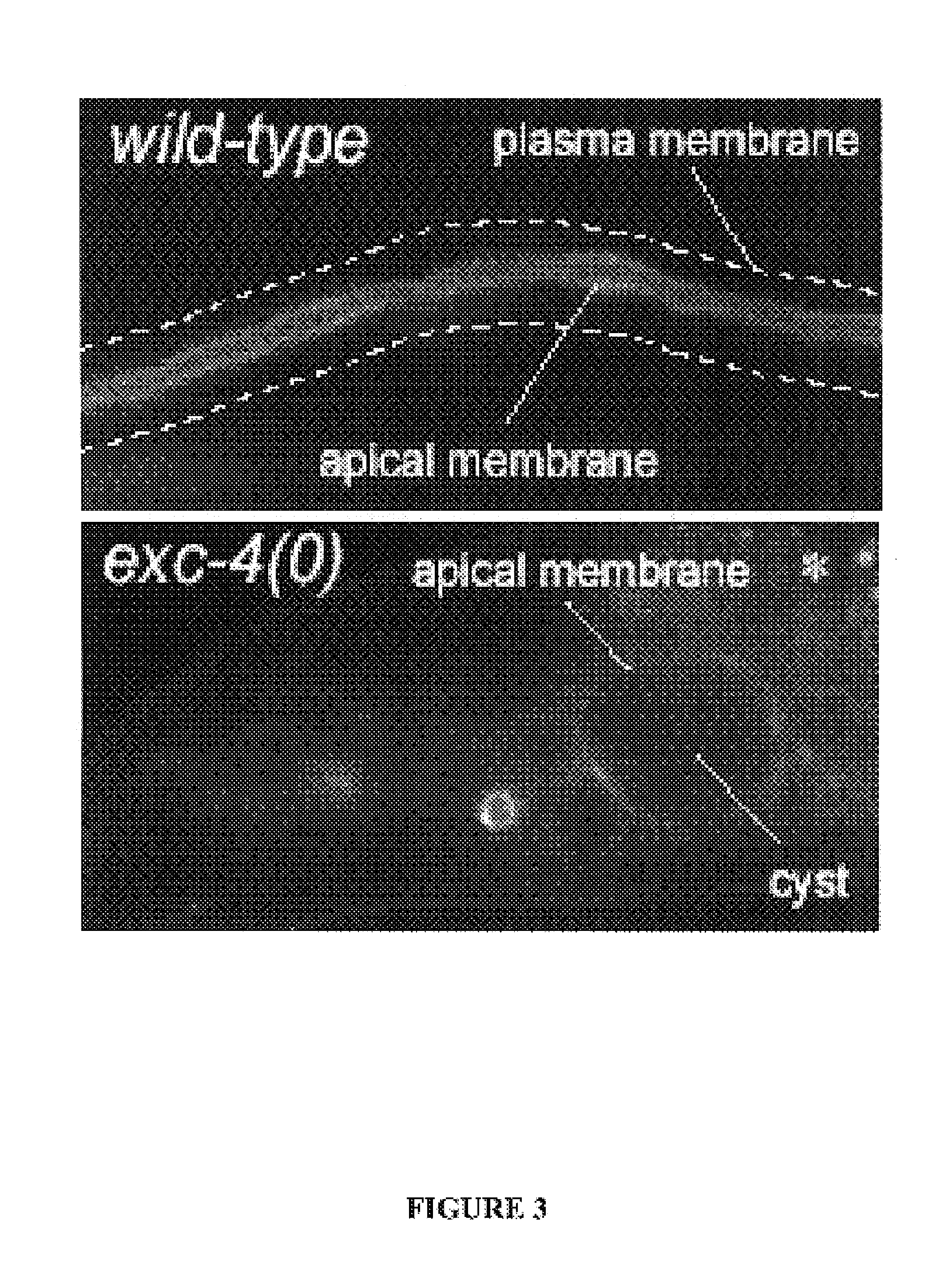 Method of screening for agents inhibiting chloride intracellular channels