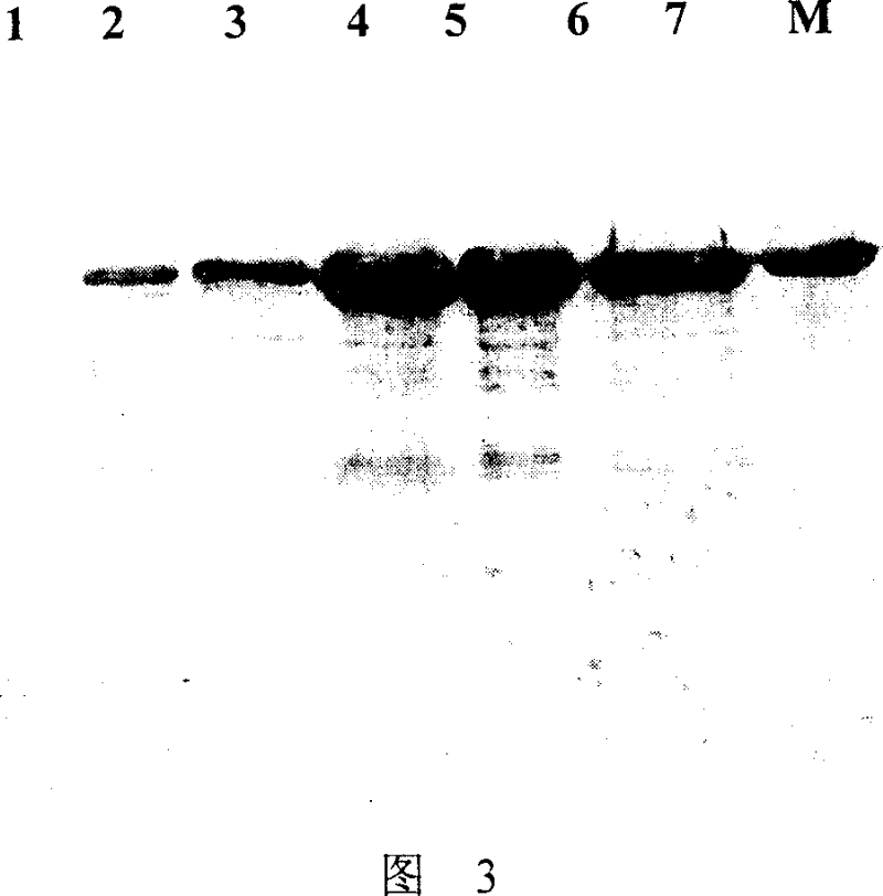 Production of recombinant anthrax protective antigen and its special expression plasmid