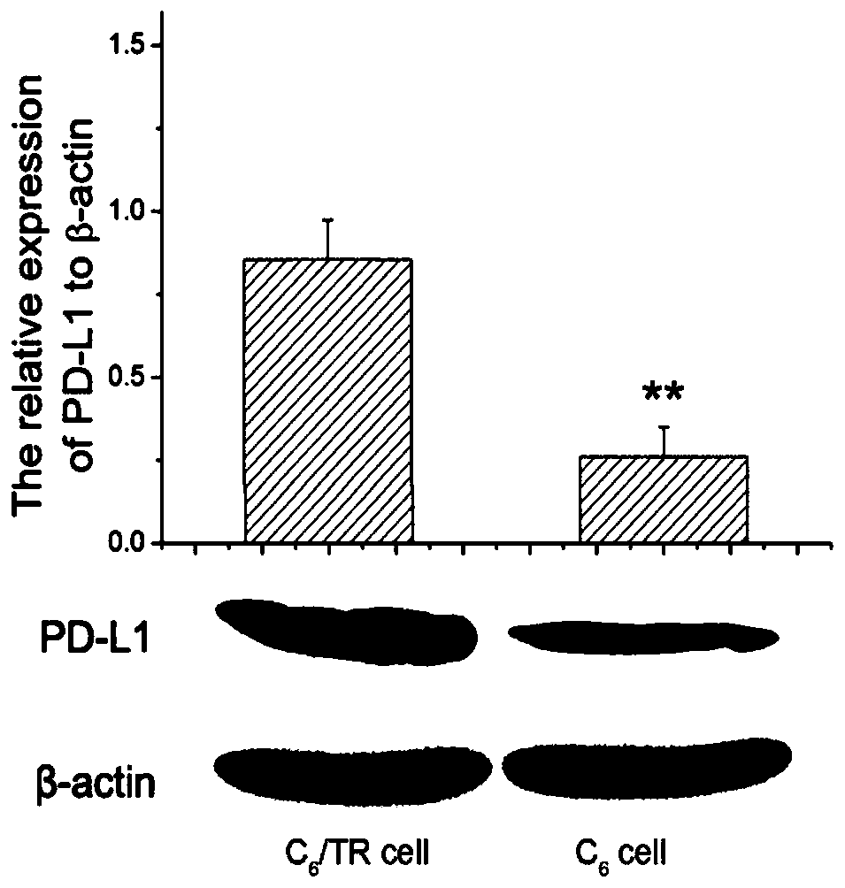 Brain-targeted drug delivery system for improving microenvironment of drug-resistant glioma and reverse drug resistance