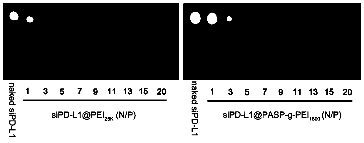 Brain-targeted drug delivery system for improving microenvironment of drug-resistant glioma and reverse drug resistance