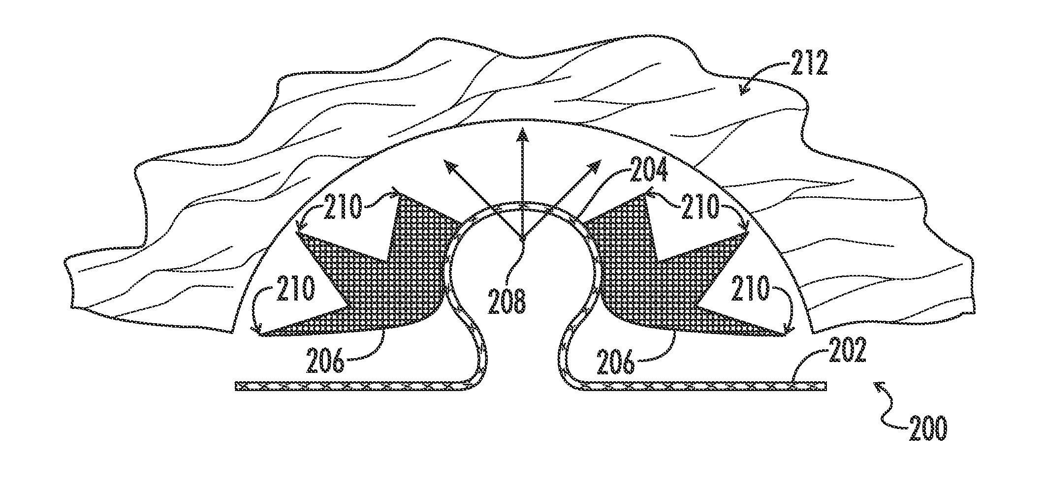 Anti-erosion sorft tissue repair device