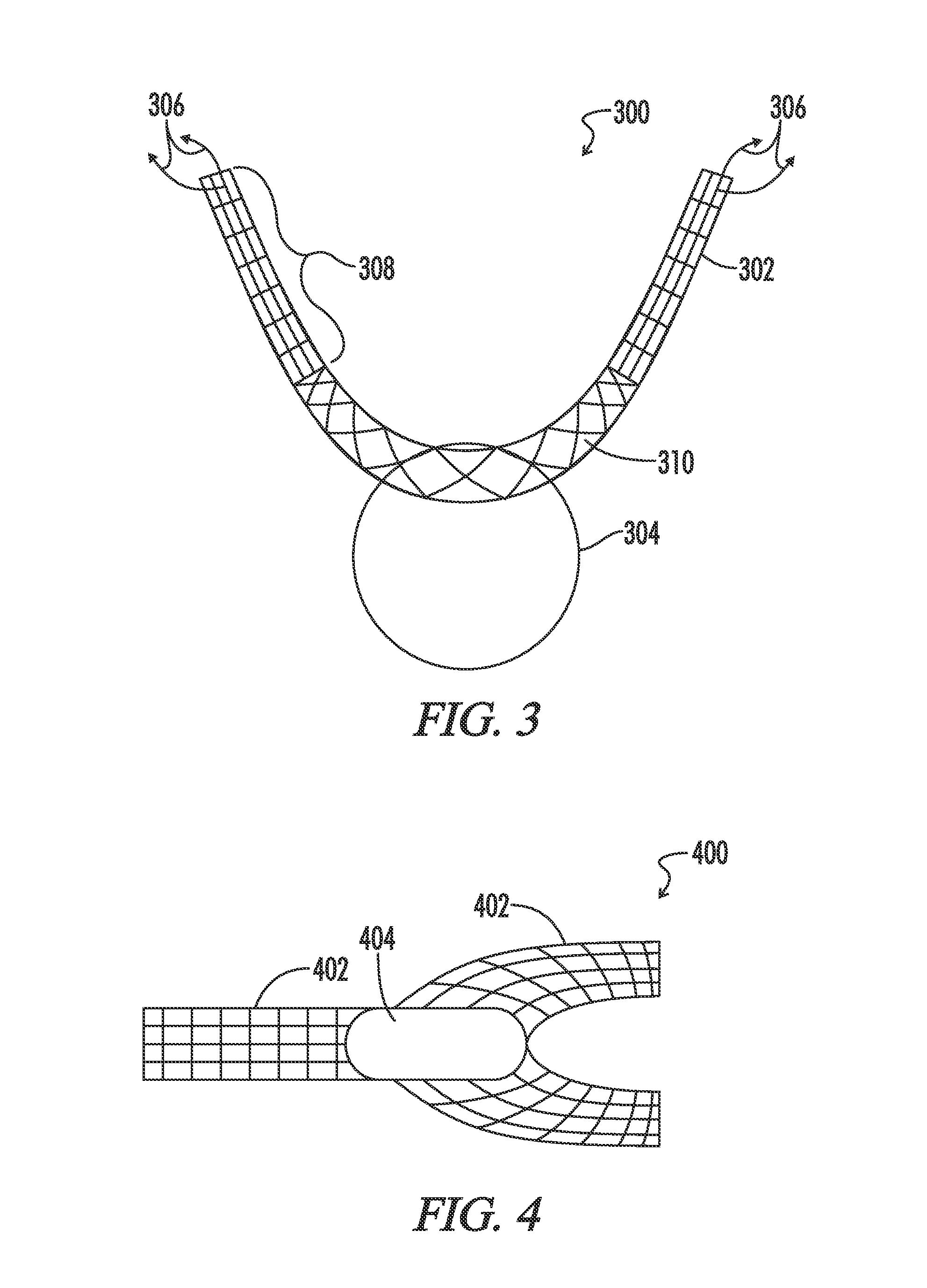 Anti-erosion sorft tissue repair device