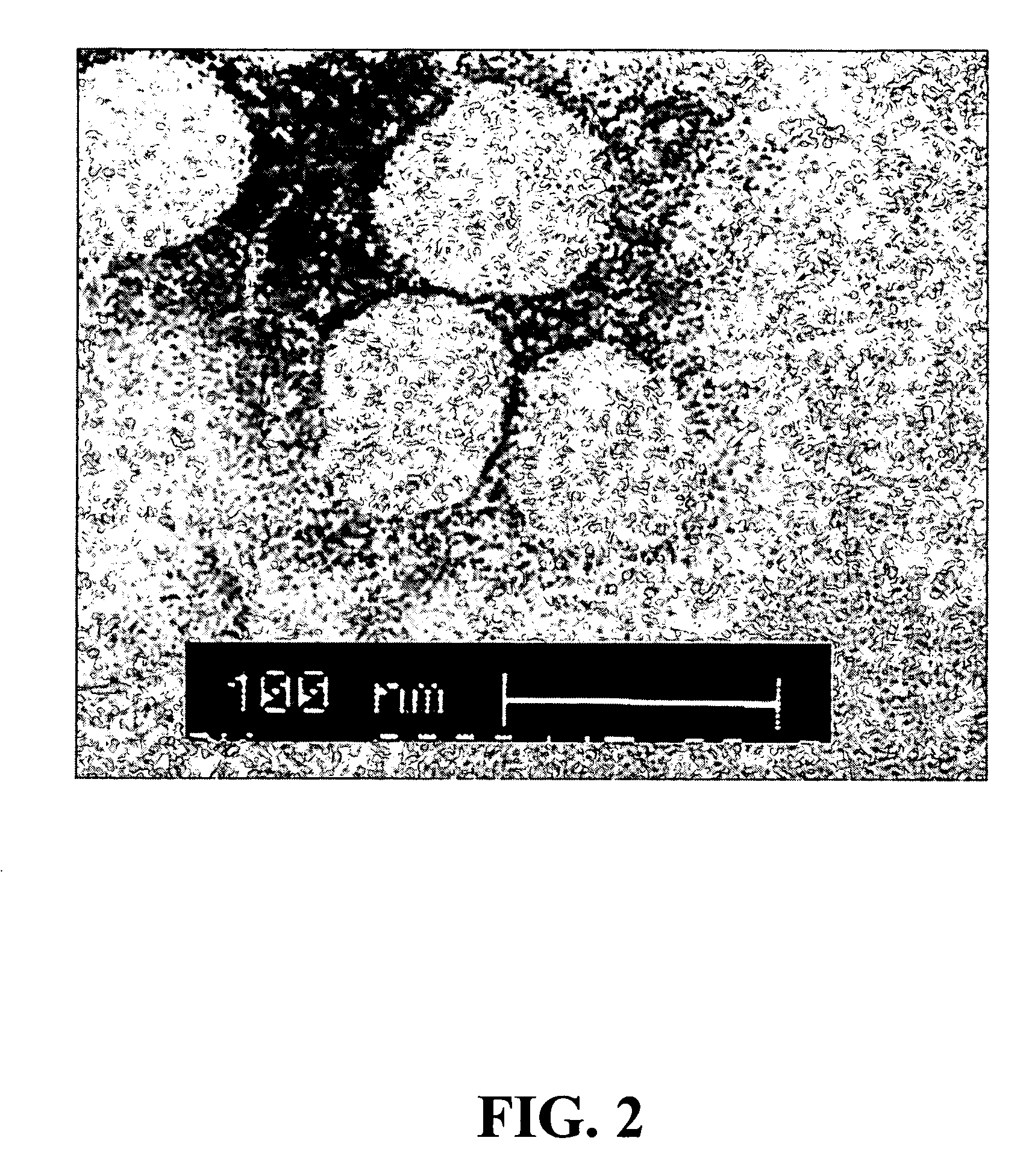 Diagnostic assay for the human virus causing severe acute respiratory syndrome (SARS)