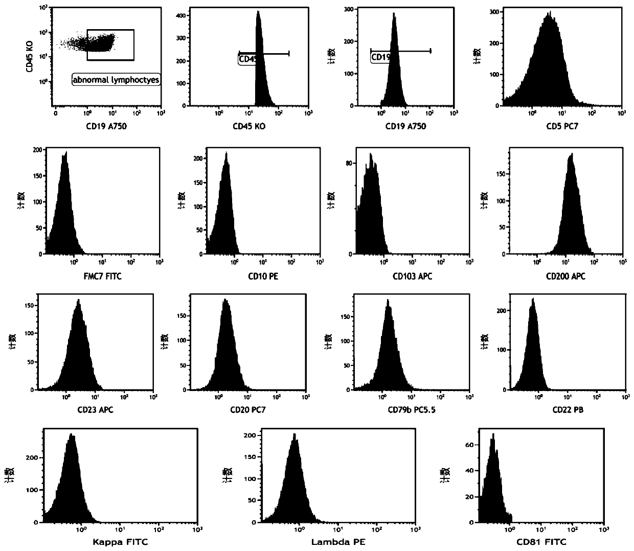 Chronic lymphocytic leukemia tumor cell recognition method based on machine learning