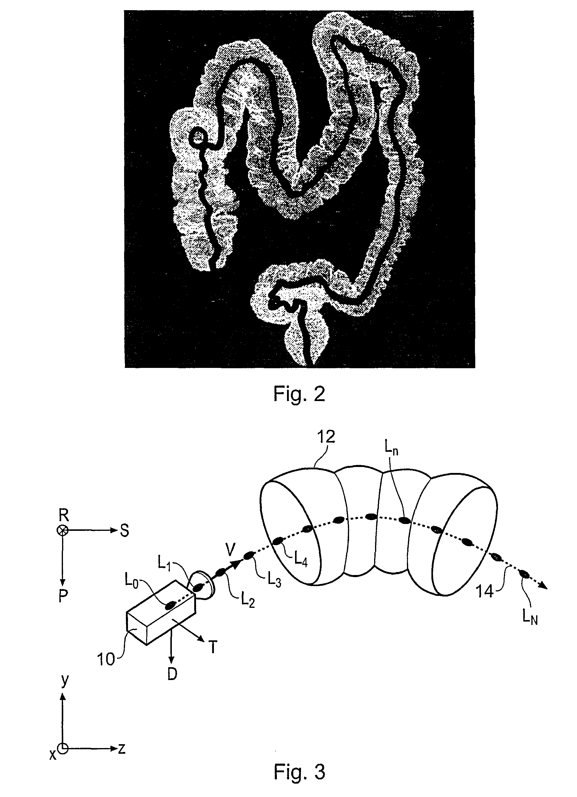 Determining a viewpoint for navigating a virtual camera through a biological object with a lumen