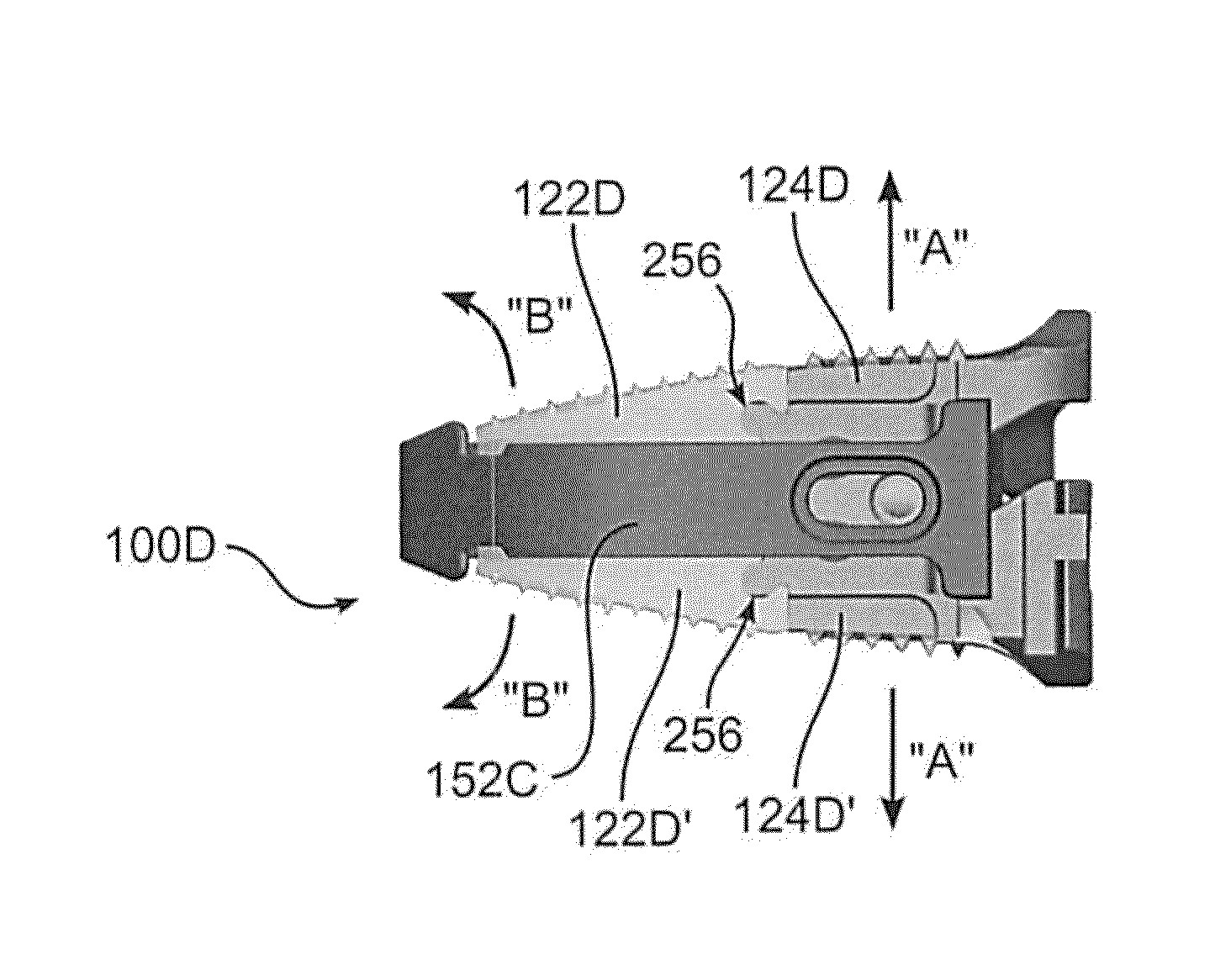 Expandable intervertebral implant