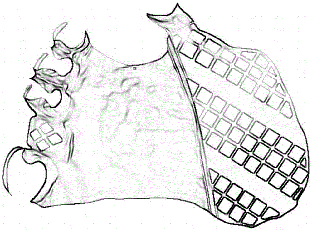 Oral prosthetic bracket manufacturing method and prosthetic bracket manufactured by metal additive