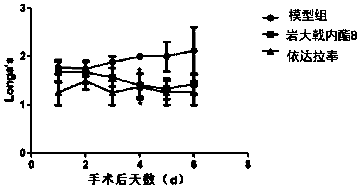 Application of abietane derivatives in preparation of drugs for prevention and treatment of cerebral ischemic diseases