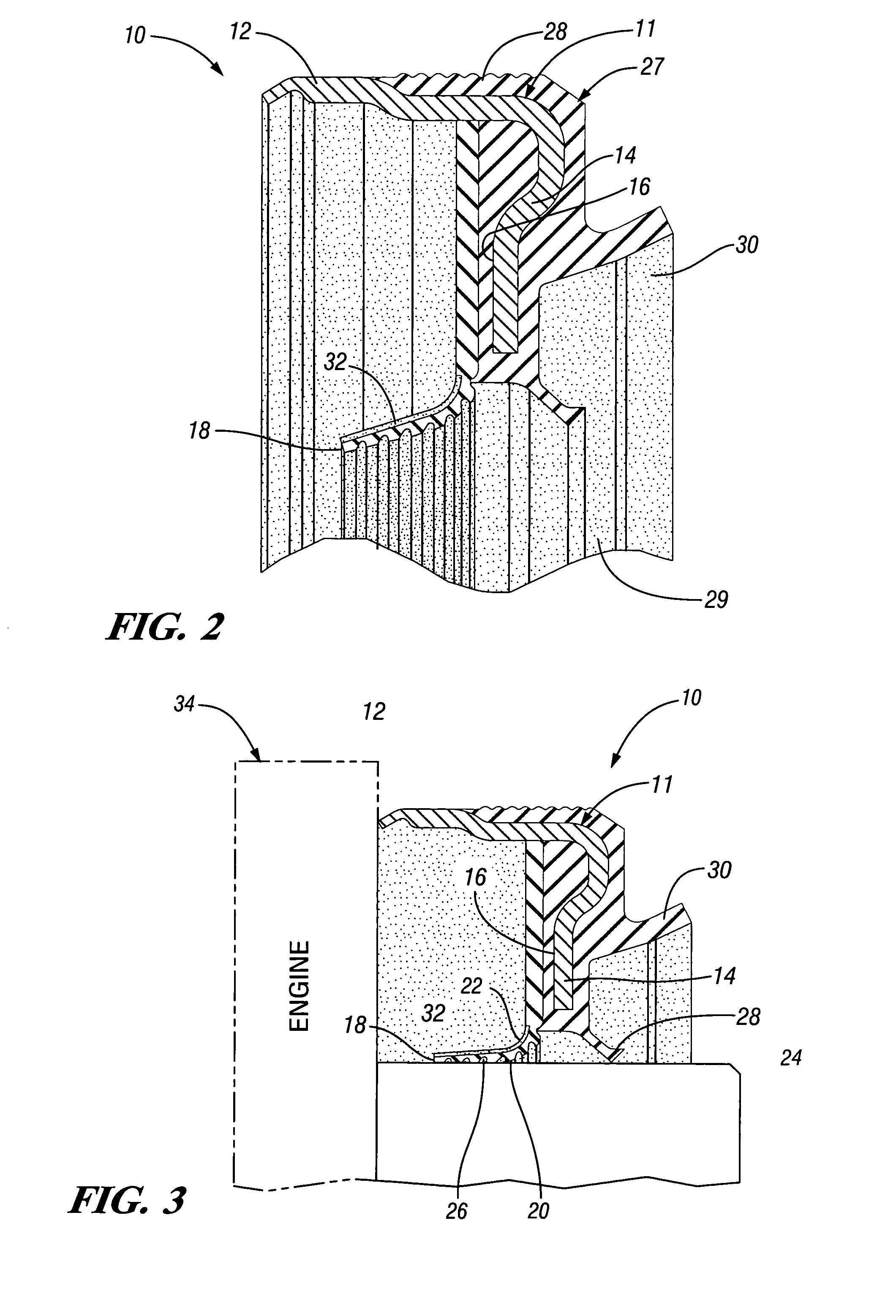 Radial lip seal