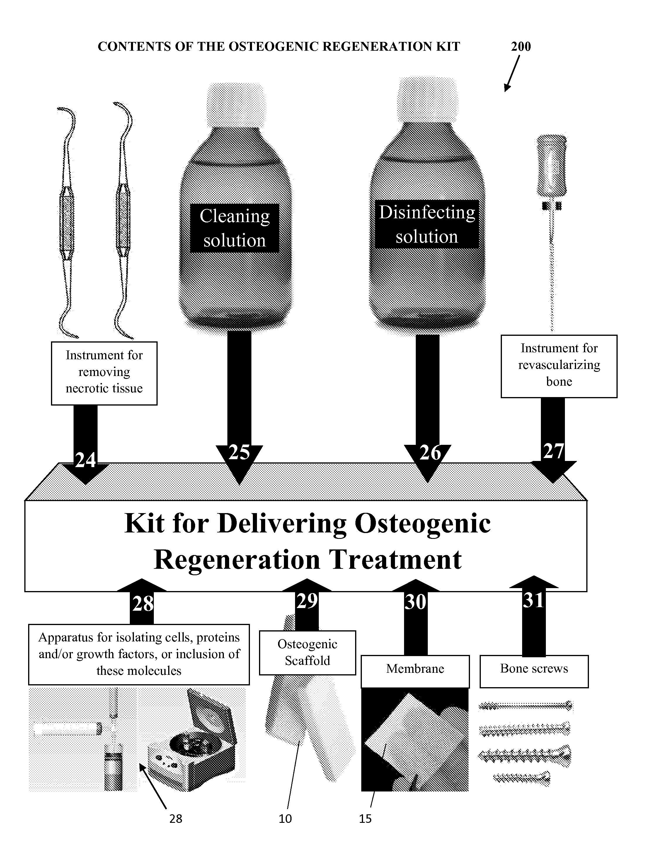 Osteogenic regenerative scaffold matrix composition