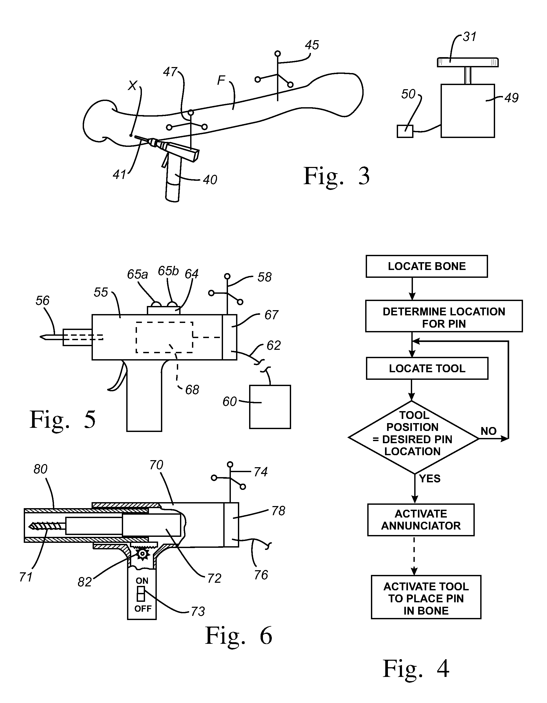 Navigated pin placement for orthopaedic procedures