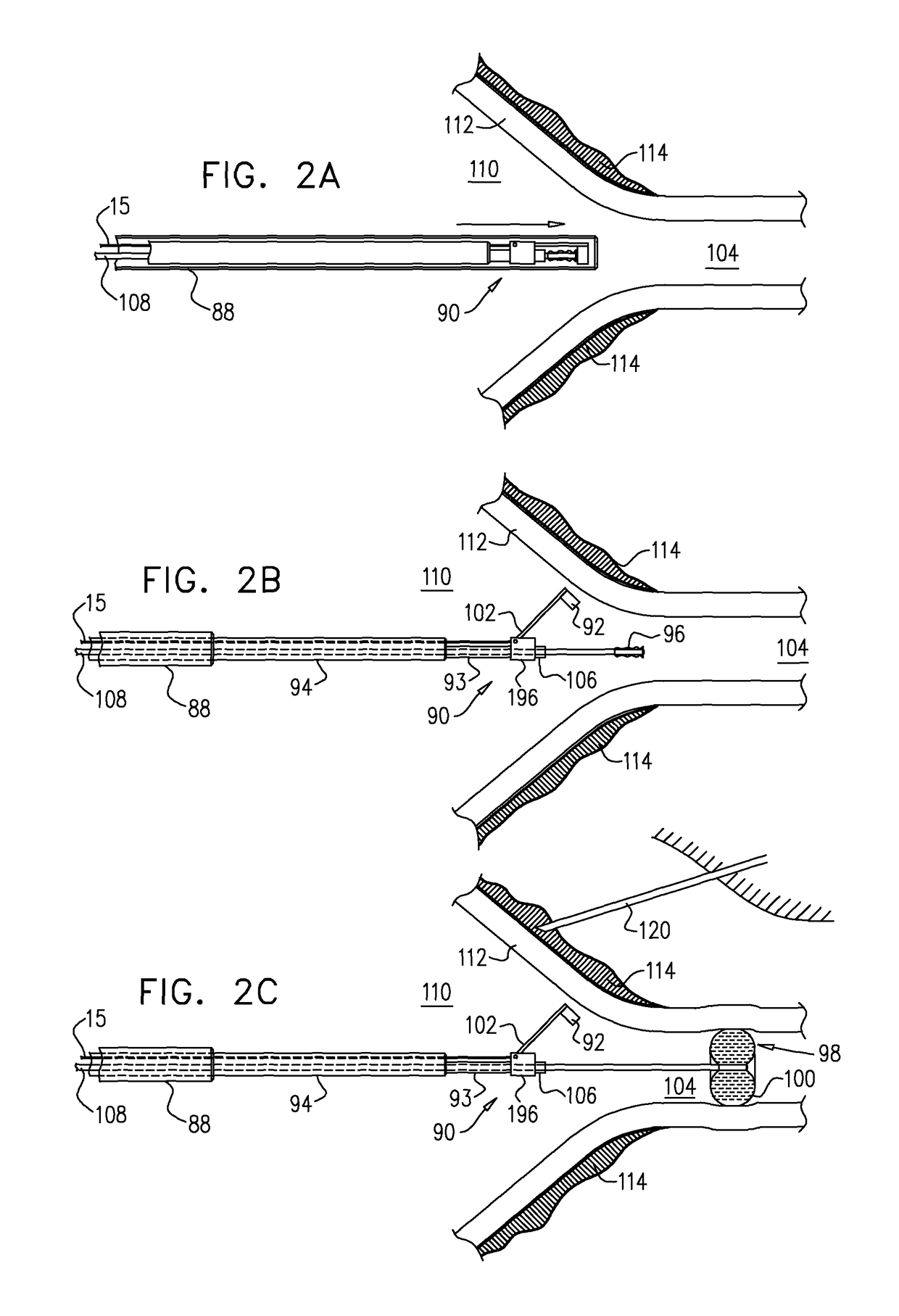 Reflectance-facilitated ultrasound treatment and monitoring