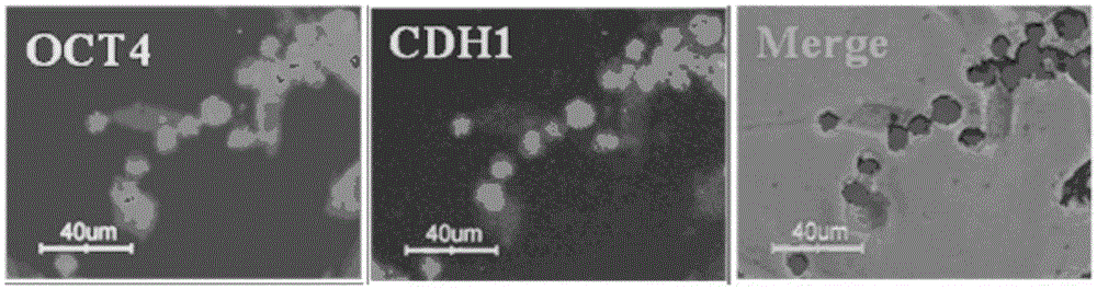 A method for isolation and purification of sheep spermatogonial stem cells, passage for long-term culture, cryopreservation and recovery