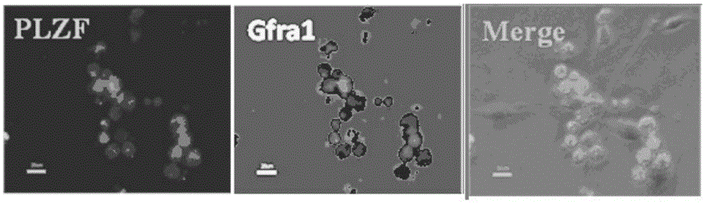 A method for isolation and purification of sheep spermatogonial stem cells, passage for long-term culture, cryopreservation and recovery