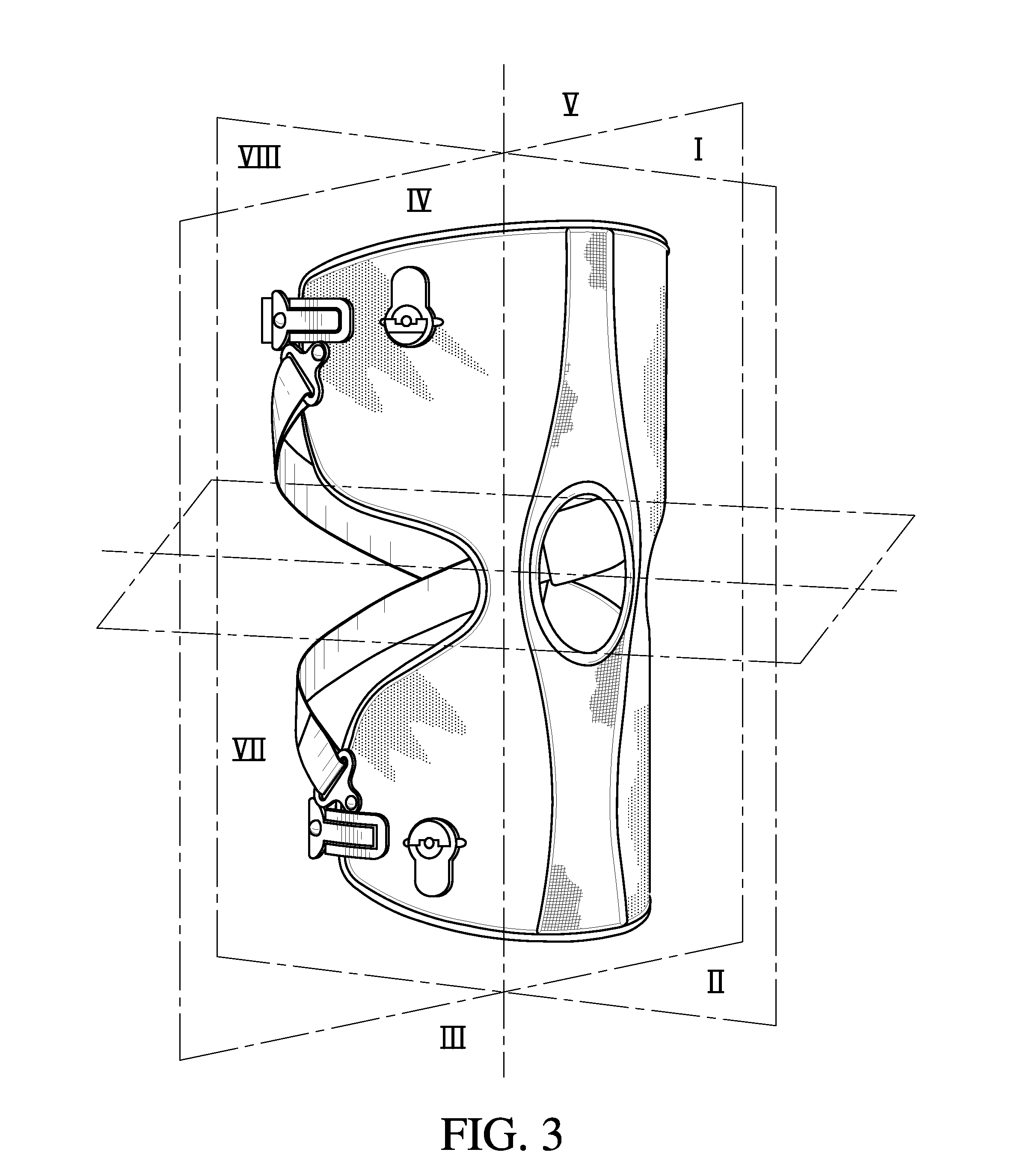 Orthopedic device