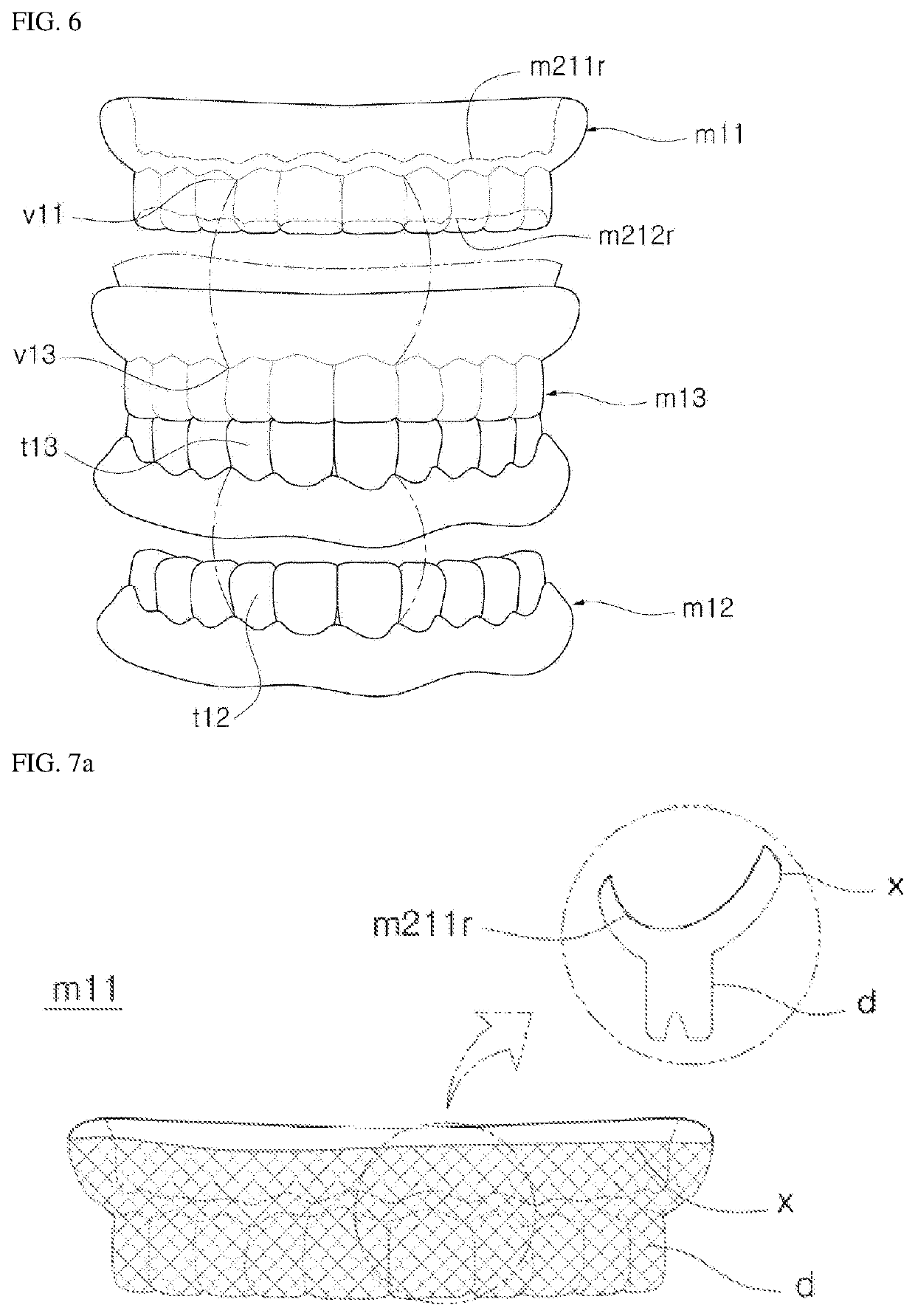 Dental restoration manufacturing method and manufacturing system, and general-purpose wax bite applied thereto