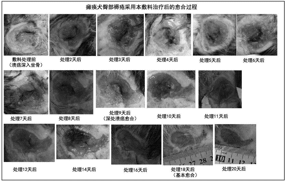 High-adsorbability foam dressing and preparing method thereof