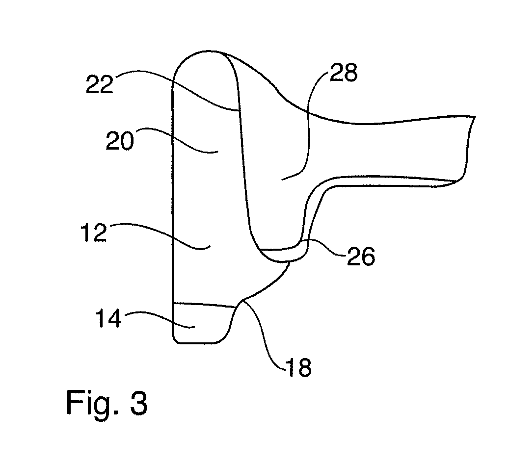 Palate-Free Upper Denture