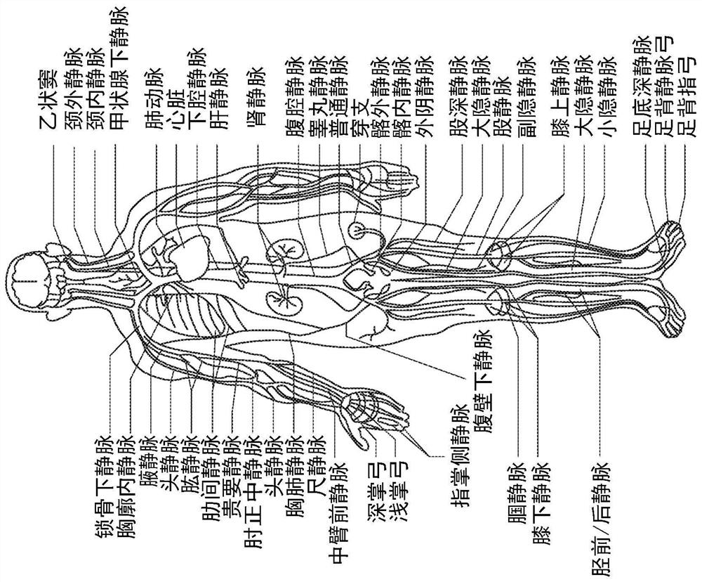 Intraluminal ultrasound vessel border selection and associated devices, systems, and methods