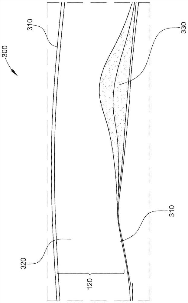 Intraluminal ultrasound vessel border selection and associated devices, systems, and methods