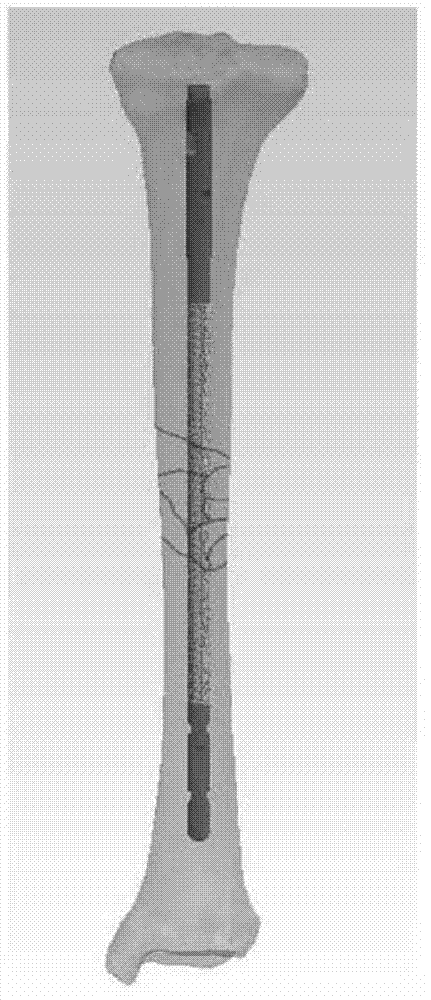 Intramedullary nail having multifunctional coating and preparation method