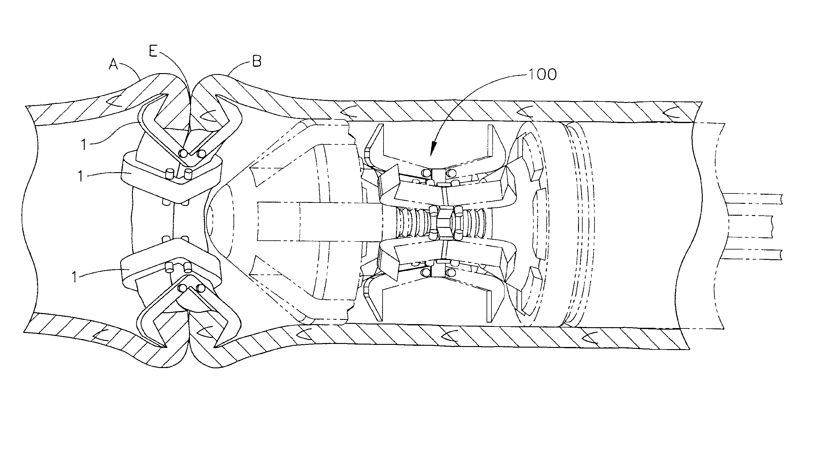 Method and Device for Effecting Anastomosis of Hollow Organ Structures Using Adhesive and Fasteners