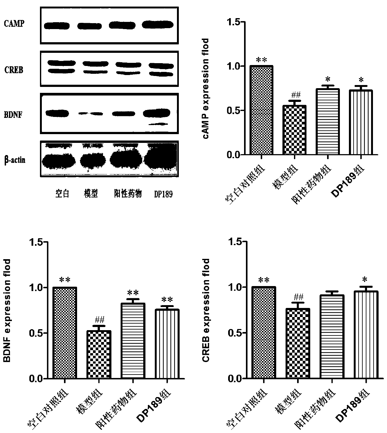 Lactobacillus plantarum DP189 and application thereof