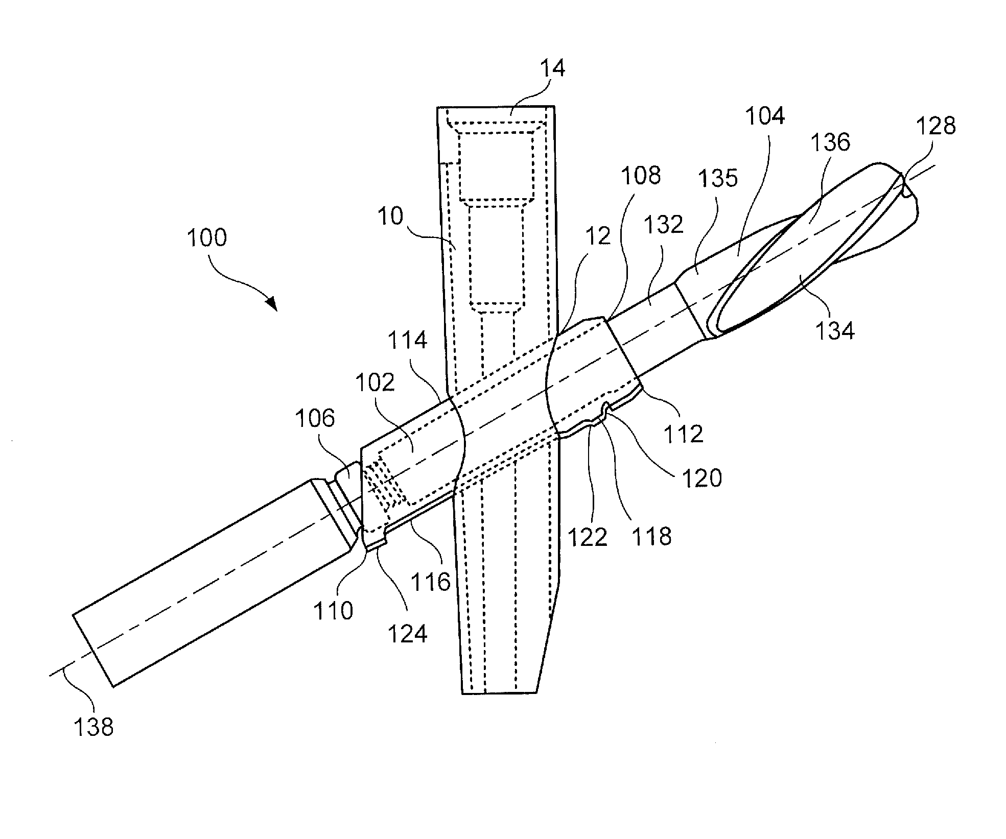 Trochanteric femoral nail augmentable