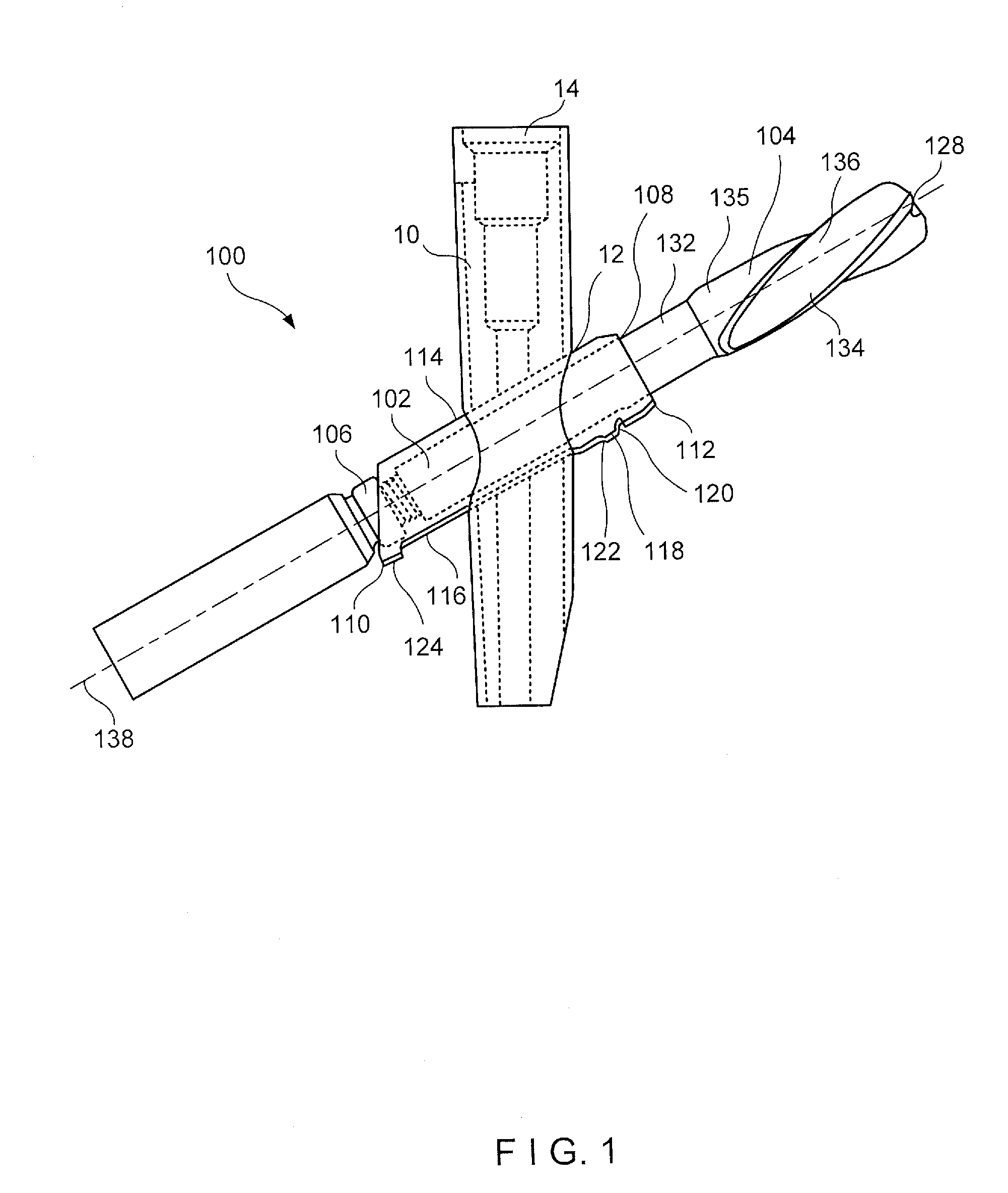 Trochanteric femoral nail augmentable