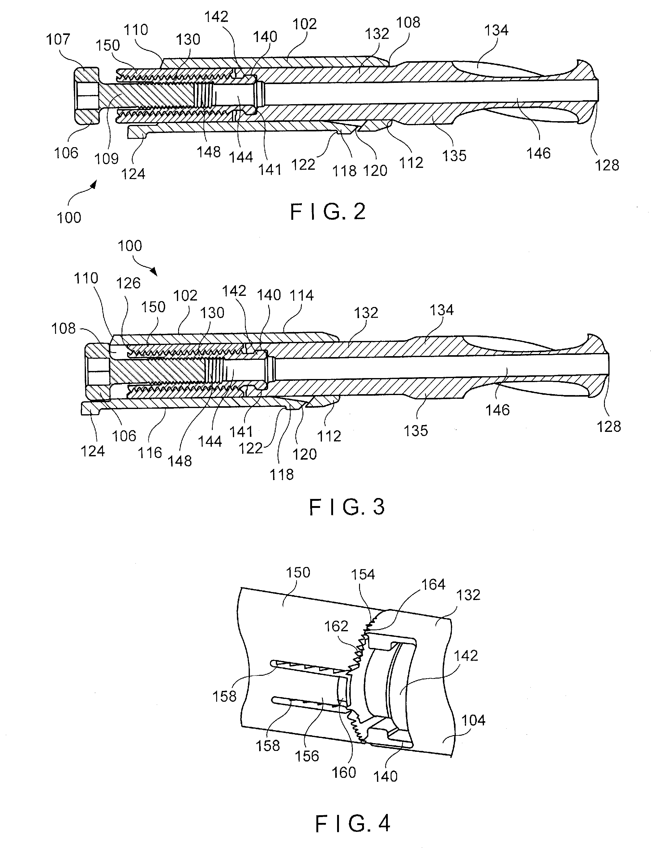 Trochanteric femoral nail augmentable