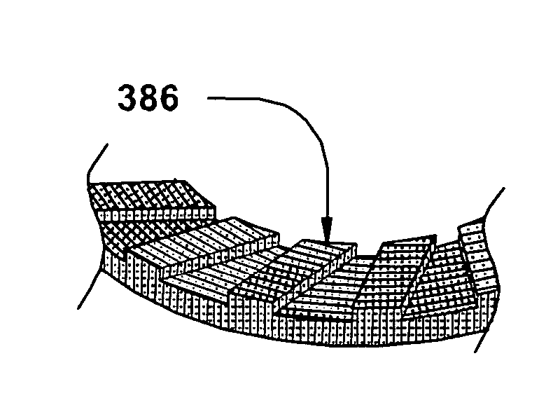 Raised island abrasive, lapping apparatus and method of use