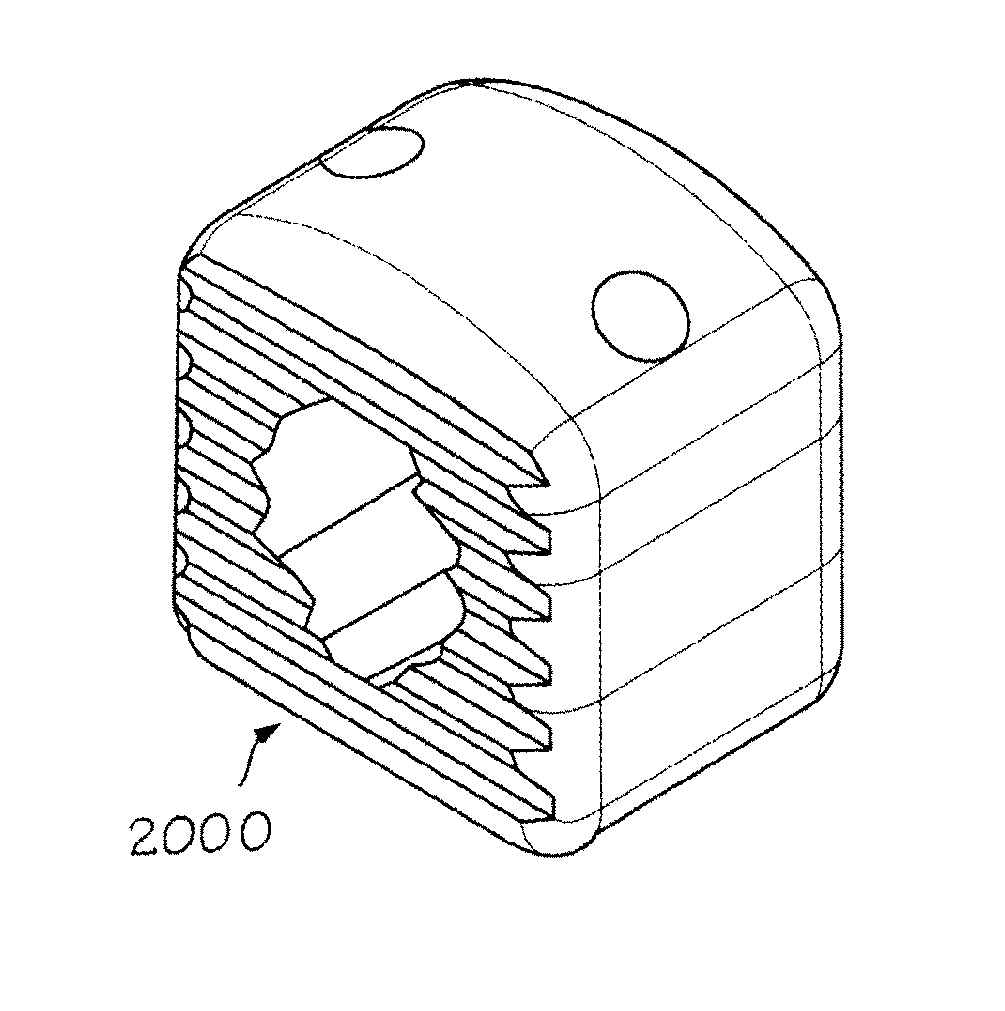 Assembled implant