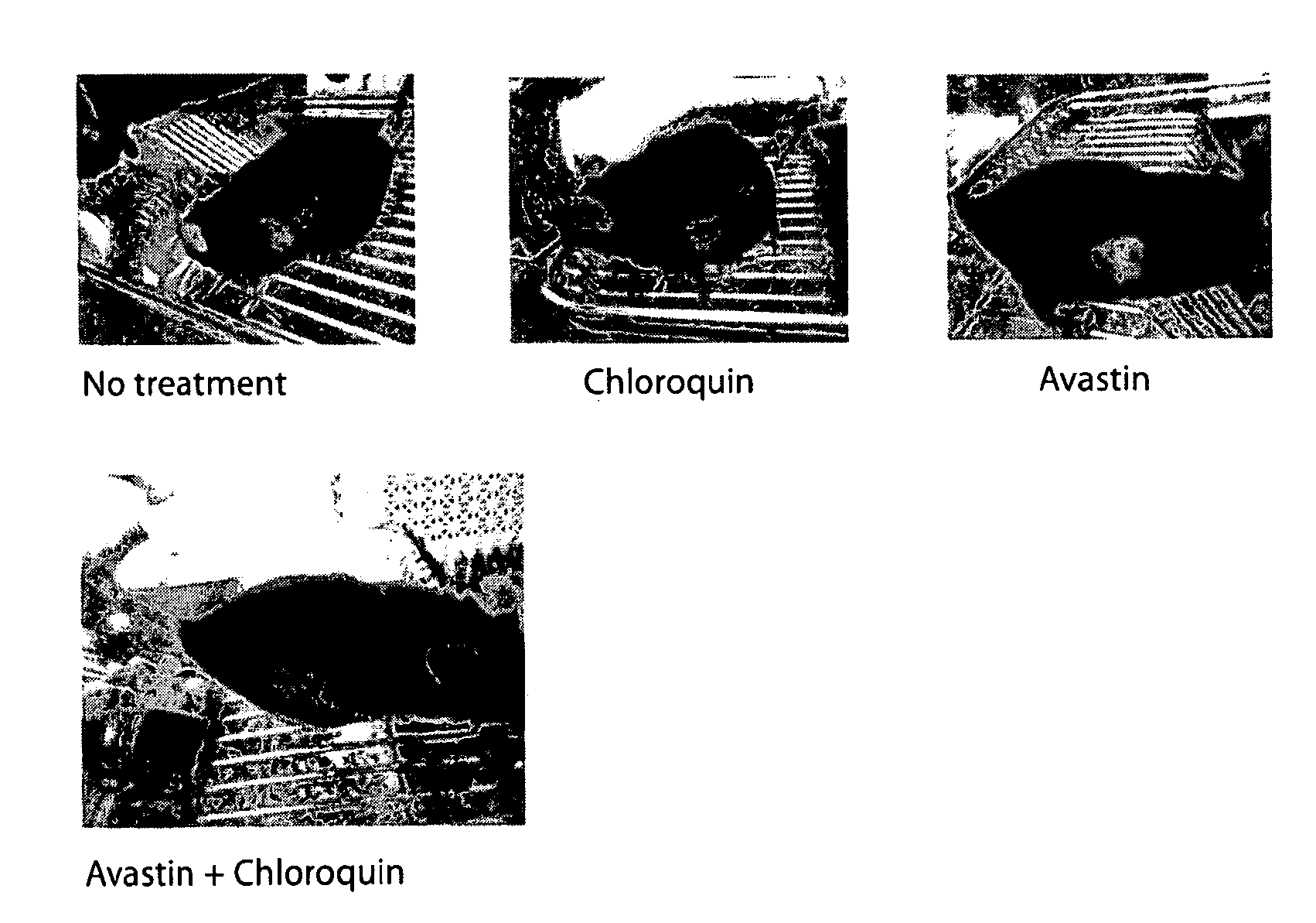 Methods and products for treating proliferative diseases